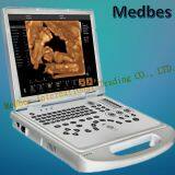 Portable 4D Color Doppler Ultrasound Scanner thumbnail-1