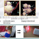 SUS Portable Lipo Diode Laser Slimming Diode Laser Medical Laser Sliming thumbnail-2