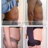 The Newest Portable Lipo Laser Weight Lose Machine for Home Use Beauty Spa With CE Approved thumbnail-6