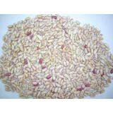 Light Speckled Kidney Beans thumbnail-1