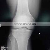 Fuji Dry Film,medical Thermal x Ray Film,fuji 35mm Film,agfa Film Dt2b,kodak Industrial Film thumbnail-1