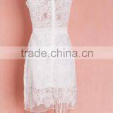 New Fashion Ladies Dress Sleeveless Lace Dress Sexy Evening Dress thumbnail-3