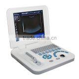 Hot Cheapest Large Screen 10.4 Inch Laptop Ultrasound Scanner Machine With Probe--RUS-9000F2 thumbnail-2