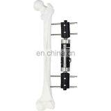 Excellent Quality Orthopedic Surgical Instruments Straight Type External Fixator Orthopedic Medical Implant External Fixation thumbnail-2