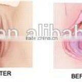 Eye Wrinkle / Bag Removal Popular Model F7+ Vaginal Fractional Rf Skin Resurfacing Co2 Fractional Laser Vaginal Tighten Machine thumbnail-6