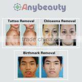 Best Solution For Tattoo Removal Nd Yag Telangiectasis Treatment Laser Type Tattoo Removal Machine Vascular Tumours Treatment thumbnail-3