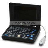 2015 New Laptop Ultrasound Scanner (PC System) on Sale thumbnail-2