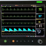 15 inch RX6800 multi-parameter patient monitor