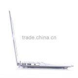 for Macbook Metal Hard Case Beautiful Colors Laptop Cases for Girls thumbnail-4