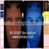 Bia Skin Analyzer Skin Scanner Analyzer Machine With Computer Best Skin Analysis thumbnail-6