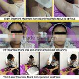 2016 OEM E-light Ipl Rf Nd Yag Laser 2.6MHZ Multifunction Machine With Rf 2014 Unwanted Hair Skin Whitening thumbnail-6