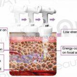 Beauty & Personal Care Best Liposonic Body Slimming Machine HIFU for Whole Body Sculpting Treatment thumbnail-2