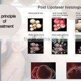 Lipolaser Slimming Machine Loss Weight and Cavitation Machine thumbnail-2