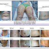 Newest Liposuction RF Vacuum Suction Auto-roller Body Fat Contour Machine thumbnail-6