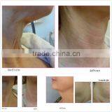 Touch Screen Viora Reaction thumbnail-6