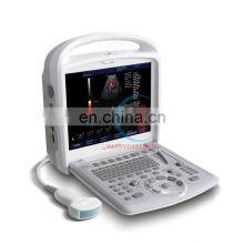 HC-A055 Medical Human or Veterinary Use 15 Inch LCD Medical Monitor Portable Fully Digital Doppler System Ultrasound Scanner thumbnail-2