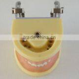 Pediatrics Typodont Teeth Model (20 Teeth) With Removable Screw Teeth thumbnail-3