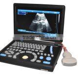 2016 New Laptop Ultrasound Machine / Scanner PC Platform With CE ISO Certification thumbnail-2