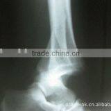 Imaging Medical Ray Film,digital X-ray Cr,fuji Dry Film Used in Hospital thumbnail-1