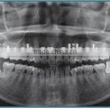 China Cheap Dental Panoramic and Cephalometric X-ray Machine thumbnail-5