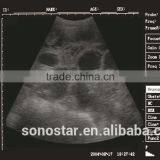 Sonostar Portable Cow Ultrasound Machine Pig Pregnancy Ultrasound Scanner Pirce V5 thumbnail-6