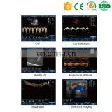 MY-A039A Color Doppler Ultrasound Price Portable Ultrasound Machine thumbnail-6