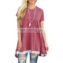 Factory Outlet 2021 Christmas Plus Size Women's Top Stitching New European and American Lace Long Sleeve Fat MM Casual Wear thumbnail-1