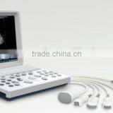 Laptop Color Doppler Ultrasound Syatem With Transducers thumbnail-1