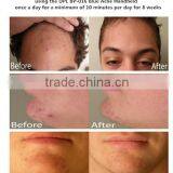 Wrinkle Removal BP016 LED Facial Photon Light Skin Rejuvenation Skin Rejuvenation Therapy Photodynamic PDT Beauty Machine thumbnail-6