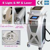 Qts-MT200 as Seen on tv Hair Removal Elight nd Yag rf Radio Frequency thumbnail-1