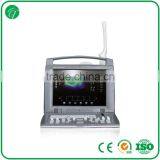 Promotion Price Cheapest 3D Laptop Color Doppler Ultrasound/doppler Ultrasound thumbnail-1