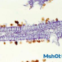 Routine Biological Microscope With Trinocular Observation Tube ML31 thumbnail-2
