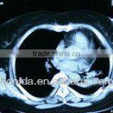 x Ray Radiography,knd,x-ray Accessory Equipment thumbnail-1
