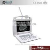 Medical Portable Ultrasonic Diagnostic System/Ultrasound scanner 3000S
