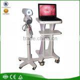 Medical Equipment Portable Digital Camera Vaginoscope Colposcope thumbnail-1