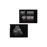 Ultrasound Scanner MD3000D thumbnail-3