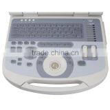 New Hot Selling Portable Ultrasound Scanner / Ultrasound Machine Suitable Clinic Community thumbnail-6