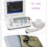 Carejoy Laptop Ultrasound Machine/Scanner With Convex Probe Ultrasonic Diagnostic System by CE ISO thumbnail-1