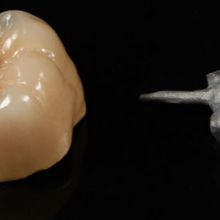 Metal Crown/bridge Chinese Denture Manufacturer thumbnail-4