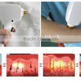 New Products 2016 808nm Diode Laser Hair Removal Machine thumbnail-5