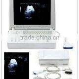 15-inch Laptop Ultrasound Scanner With Multi-frequency Probes thumbnail-1
