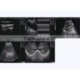 China Beijing 10.7 Inch Color LCD 2B Ultrasound Imaging System Laptop Ultrasound Scanner With CE ISO Approved thumbnail-3