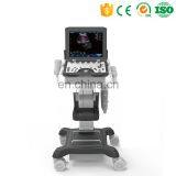 MY-A039A Color Doppler Ultrasound Price Portable Ultrasound Machine thumbnail-4