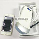 Wireless Convex Probe Scanner, WiFi, Used in Surgery Without Fixing of Cables, 3.5MHz / R40 / 64 Elements, SIFULTRAS-5.1 thumbnail-5