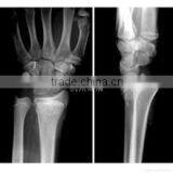 Led Konida Dry Hot Sex Medical Laser Film Fuji Dry 14*17 Agfa Medical Film thumbnail-1