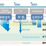 Painless HIFU-C High Intensity Wrinkle Removal Face Lift Machine High Focused Ultrasonic thumbnail-2