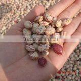 2015 New Crops of Light Speckled Kidney Beans thumbnail-4