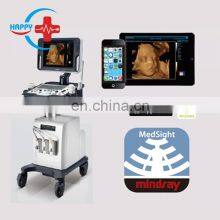 Mindray DC-30 Ultrasound Equipment/Mindray Color Doppler Ultrasound thumbnail-3