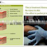 Painless Stationary Beauty Equipment Salon And Home Use 8 White In 1 With Multi Function Acne Removal Swing Arm thumbnail-3