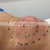 3 Applicators Body Slimming Cryo Fat Freeze Machines thumbnail-6